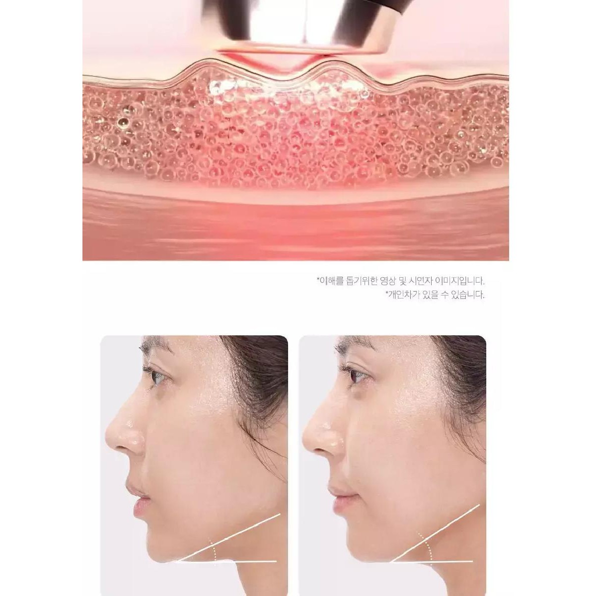 Medicube AGE-R Booster Pro Συσκευή Φωτοθεραπείας Προσώπου 6-σε-1 Pink