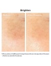 Shiseido Vital Perfection Uplifting And Firming Advanced Cream 50ml Αντιγηραντική Κρέμα Προσώπου