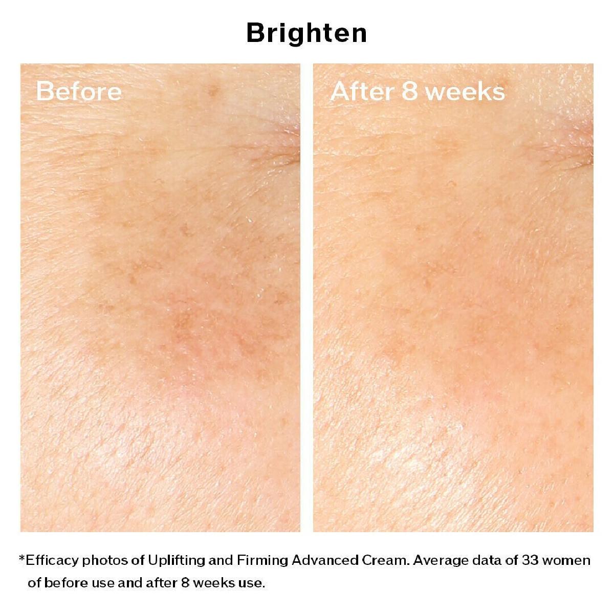 Shiseido Vital Perfection Uplifting And Firming Advanced Cream 50ml Αντιγηραντική Κρέμα Προσώπου