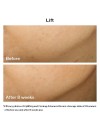 Shiseido Vital Perfection Uplifting And Firming Advanced Cream 50ml Αντιγηραντική Κρέμα Προσώπου